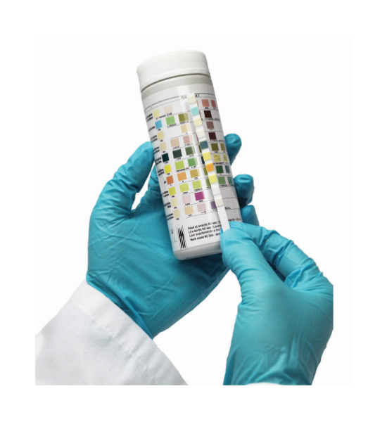  CYANSTRIP MINI (URINE STRIP READER)